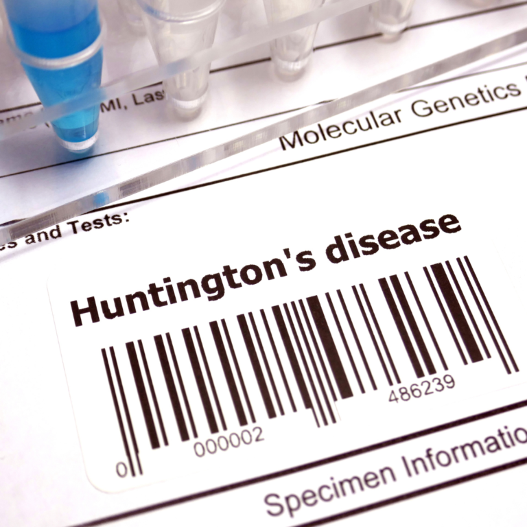 ziekte van Huntington