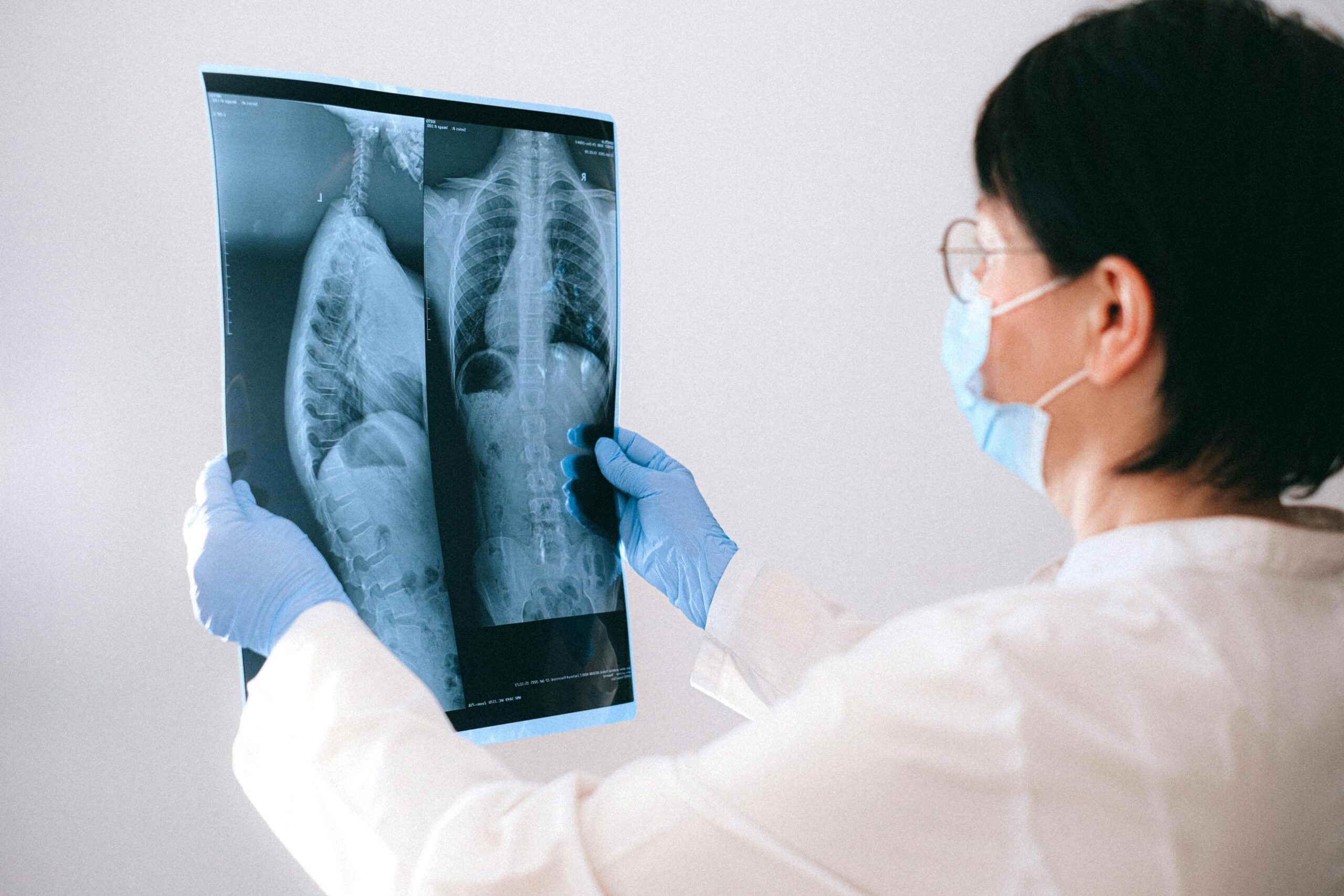 longfibrose