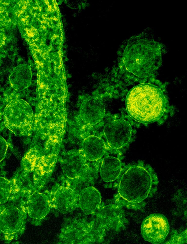 bacterie in je lichaam