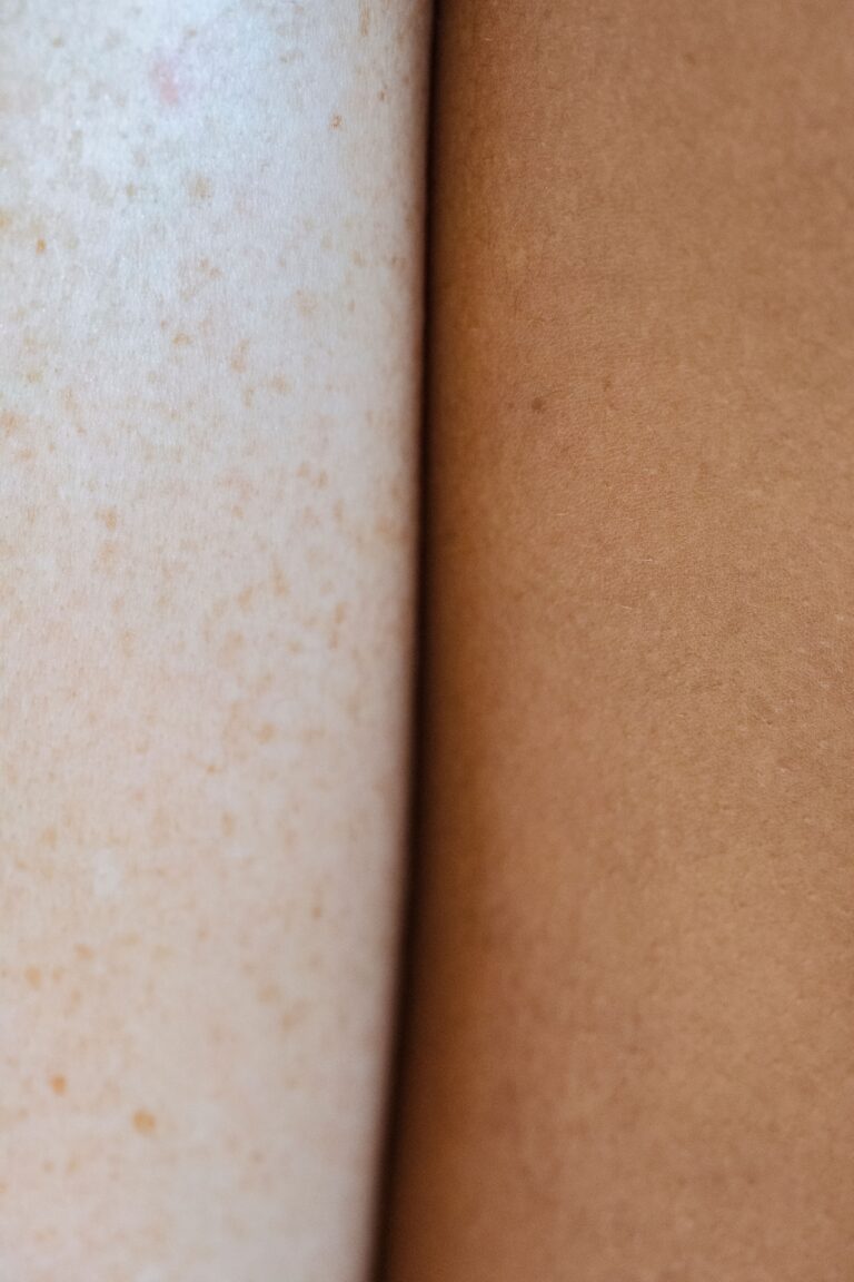 bloedblaren